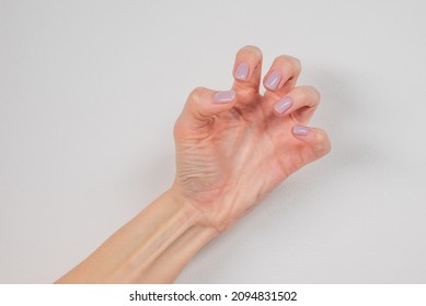 Hands With Convulsions And Muscle Spasms, At The Time Of An Epileptic Seizure