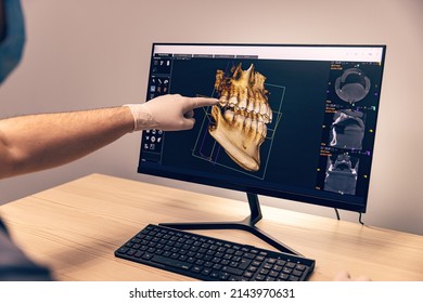 Hands of doctor dentist in gloves show the teeth on x-ray on digital screen in dental clinic - Powered by Shutterstock