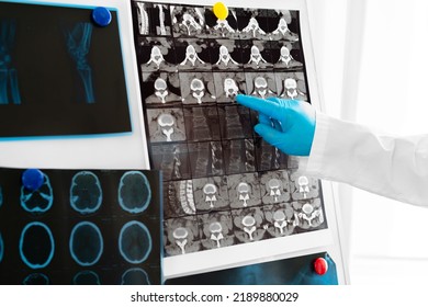 Hands Of A Doctor Holding Head Mri Scan