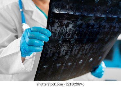 Hands Of A Doctor Holding Head Mri Scan