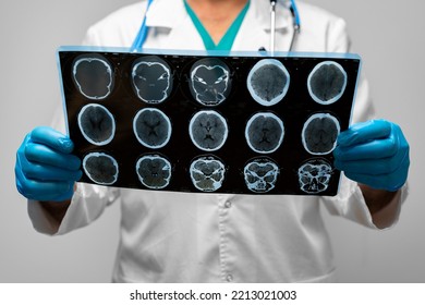 Hands Of A Doctor Holding Head Mri Scan