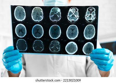 Hands Of A Doctor Holding Head Mri Scan