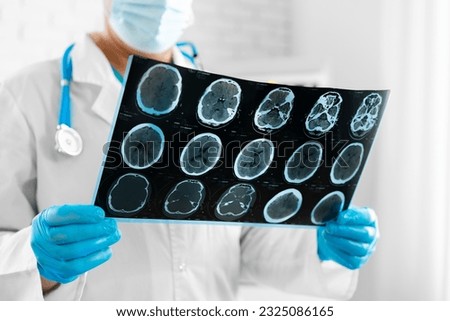 Hands of a doctor holding head scan