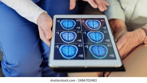 Hands, doctor and patient with tablet, brain scan and healthcare with results for MRI x ray, diagnosis and medical advice. Closeup, nurse and person with technology, cancer genome and tumor with risk - Powered by Shutterstock