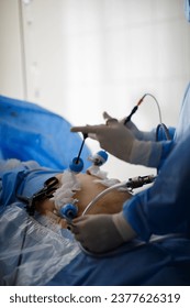 hands of doctors performing laparoscopy operations. High quality photo