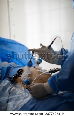 hands of doctors performing laparoscopy operations. High quality photo