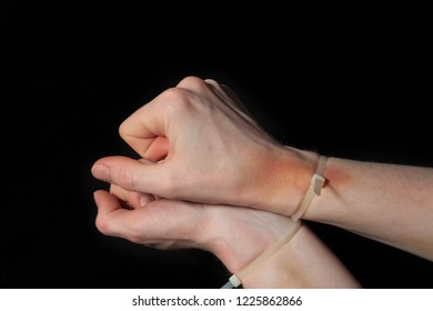 Hands In Handcuffs, Plastic Zip Tie On A Black Background. Big Bruise And Restriction Of Freedom.