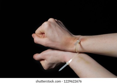 Hands In Handcuffs, Plastic Zip Tie On A Black Background. Big Bruise. 