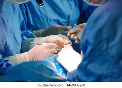 Hands Hold Syringes To Carry Fat During Work. The Operation To Transfer Fat From One Part Of The Body To Another. Platsichiskaya Surgery, Beauty, Change Of Appearance.