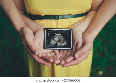 Hands Holding Ultrasound Baby Photo