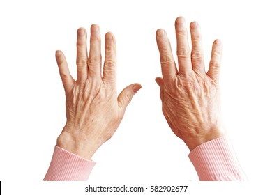 Hands of an old woman with arthritis, isolated on white