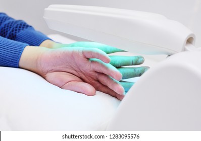 Hands Of A Patient With Psoriasis Close-up Under An Ultraviolet Lamp. Light Therapy, Phototherapy