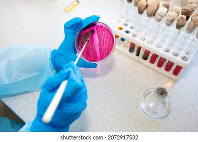 The Hands Of A Physician Laboratory Assistant In An Infectious Disease Laboratory Examines The Samples.