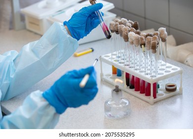 The Hands Of A Physician Laboratory Assistant In An Infectious Disease Laboratory Examines The Samples.