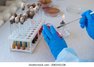 The Hands Of A Physician Laboratory Assistant In An Infectious Disease Laboratory Examines The Samples.