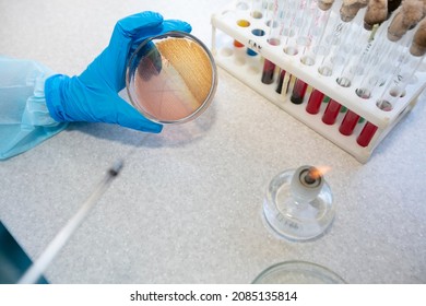 The Hands Of A Physician Laboratory Assistant In An Infectious Disease Laboratory Examines The Samples.