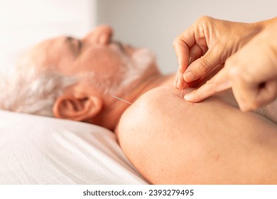 The hands of a physiotherapist place needles on the shoulder of an older man, during an acupuncture session in a physiotherapy clinic - Powered by Shutterstock