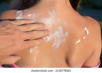 Hands Are Rubbing Suntan Cream On The Back. Close-up Of Applying Sunscreen. Summer Skin And Body Care. Man Using Foam To Protect The Skin. Sun Protection Concept