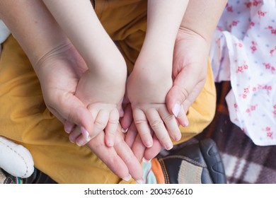 The Hands Of A Small Child With Paralysis In The Hands Of His Mother. Family Support. Mother's Love. Disability. Disabled Child.