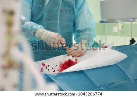 The hands of a surgeon.