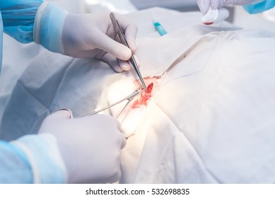 Hands Of Surgeon And Assistant During Surgery, Medical Instruments, Scalpel, Conceptual Photo Of Medicine