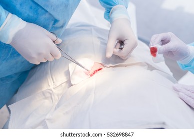 Hands Of Surgeon And Assistant During Surgery, Medical Instruments, Scalpel, Conceptual Photo Of Medicine