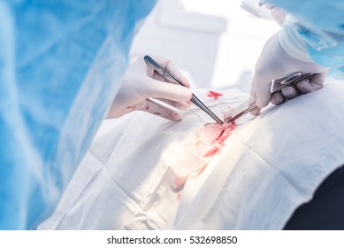 Hands Of Surgeon And Assistant During Surgery, Medical Instruments, Scalpel, Conceptual Photo Of Medicine