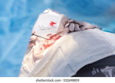 Hands Of Surgeon And Assistant During Surgery, Medical Instruments, Scalpel, Conceptual Photo Of Medicine