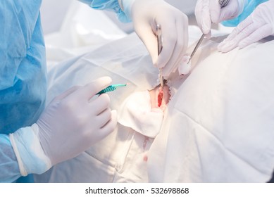 Hands Of Surgeon And Assistant During Surgery, Medical Instruments, Scalpel, Conceptual Photo Of Medicine