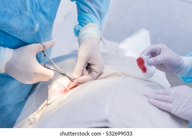 Hands Of Surgeon And Assistant During Surgery, Medical Instruments, Scalpel, Conceptual Photo Of Medicine