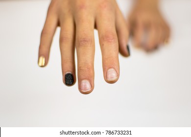 The Hands Of A Teenage Girl With A Bad Old Manicure.