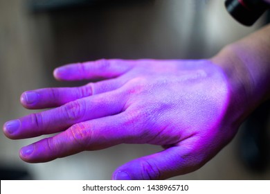 Hands Under Black UV Light To Detect Glow In The Dark Germs Around Nails And Fingerprint As Visual Tool For Teaching Proper Handwashing, Aseptic Techniques, And General Infection Control