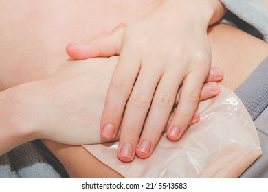 The hands of a young caucasian man press tightly the colostomy bag on an adhesive circle around the small intestine sticking out on the stomach,  top view. The concept of a step-by-step replacement of