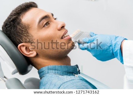 handsome african american man smiling near teeth color palette before whitening procedure