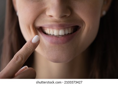 Happy girl showing toothy smile, pointing finger at healthy white teeth. Clinic patient satisfied with dentist service, enamel cleaning, whitening, dental care, correction. Cropped shot, close up