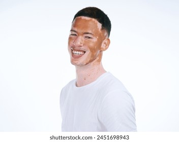 Happy, handsome and portrait of man with vitiligo or skin pigmentation on a white studio background. Face of unique and confident male person or albino with smile for melanin condition or mixed tone - Powered by Shutterstock