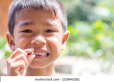 Happy little Asian boy smiling and showing his missing teeth. Cute little boy lost first milk tooth. Child showing his milk-tooth that has fallen