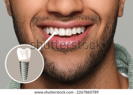 Happy man with perfect teeth smiling on grey background, closeup. Illustration of dental implant