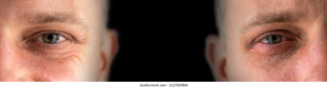 Happy And Sad Face Of The Same Man Against Black Background