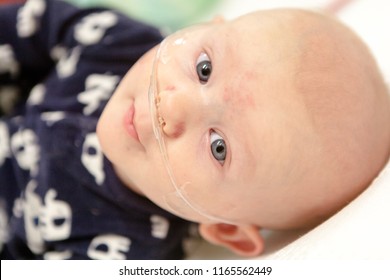 A Happy Smiling Baby With A Breathing Tube In Their Nose Receiving Medical Treatment.