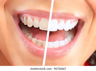 Happy smiling woman. Dental health background.