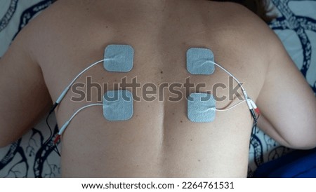 Harnessing Technology for Relaxation and Rehabilitation, Exploring the Benefits of Electronic Stimulation in Physical Therapy, Revitalizing the Body with Electronic Stimulation, 