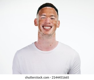 I have my flaws but I embrace them and love them because theyre mine. Portrait shot of a handsome young man with vitiligo posing on a white background. - Shutterstock ID 2144451665