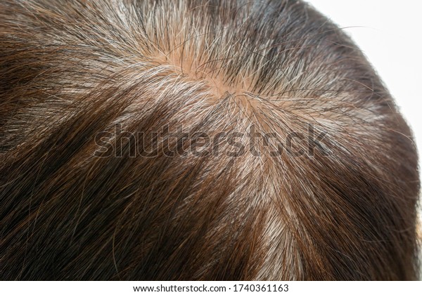 Head of an elderly woman with gray hair that grew\
after dyeing