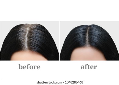 Head Of A Girl With Black Gray Hair. Hair Coloring. Before And After.