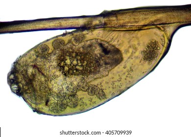 Lice Eggs Images Stock Photos Vectors Shutterstock