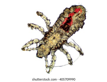 Head Lice Louse Medical Images Stock Photos Vectors Shutterstock