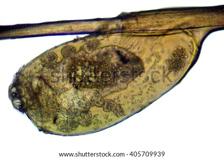 Head Louse - Pediculus capitis, microscope picture, hair strand with the louse egg