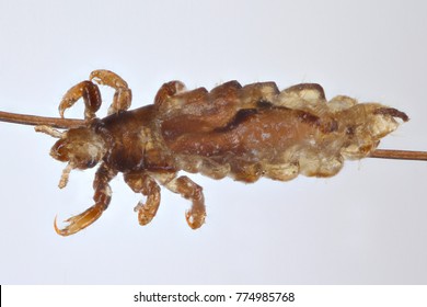 The Head Louse (Pediculus Humanus Capitis) Is An Obligate Ectoparasite Of Humans That Causes Head Lice Infestation (pediculosis Capitis) On The Hair