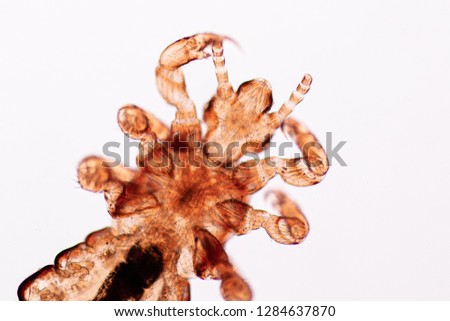 The head louse (Pediculus humanus capitis) is a parasite Live on the body, person or animal and live by sucking blood into food.